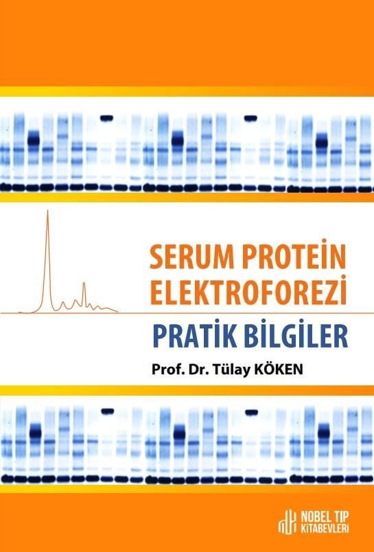 Serum Protein Elektroforezi: Pratik Bilgiler