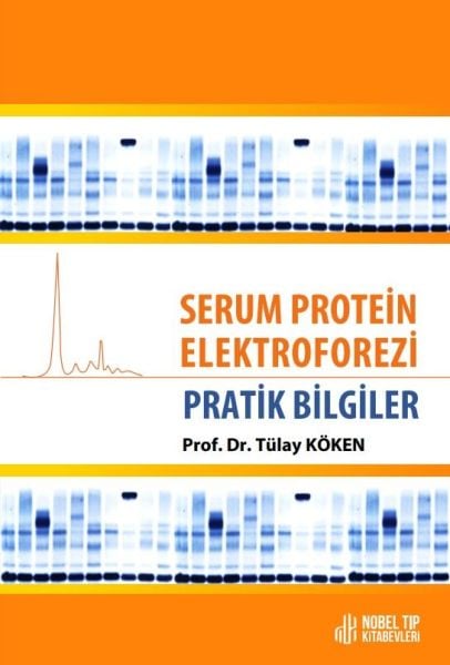 Serum Protein Elektroforezi: Pratik Bilgiler