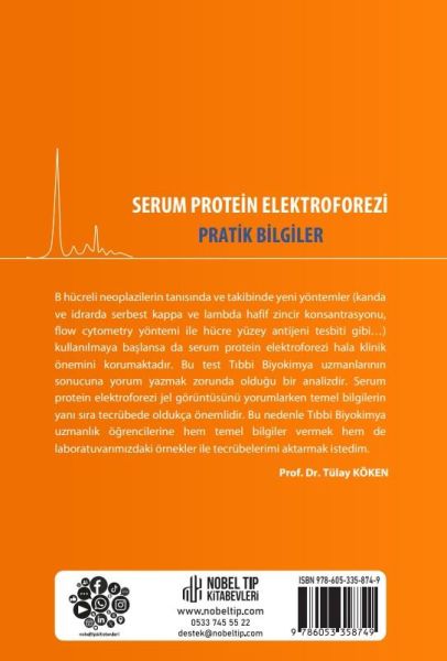 Serum Protein Elektroforezi: Pratik Bilgiler