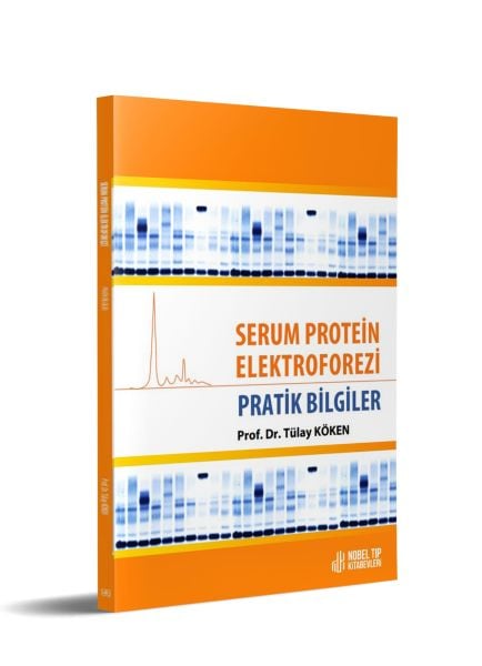 Serum Protein Elektroforezi: Pratik Bilgiler