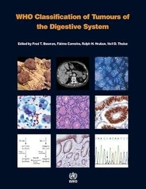 Who Classification of Tumors of Digestive system