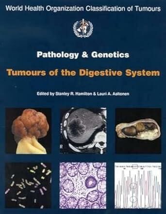 Who Pathology of The Genetics Tumors of Endocrine