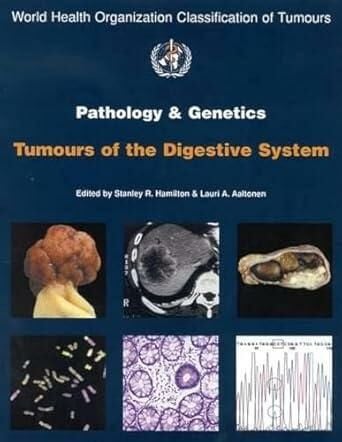 Who Pathology of The Genetics Tumors of Endocrine