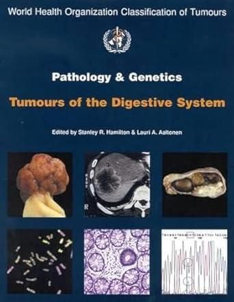 Who Pathology of The Genetics Tumors of Endocrine