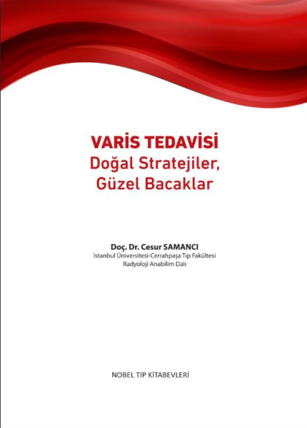 Varis Tedavisi Doğal Stratejiler,Güzel Bacaklar
