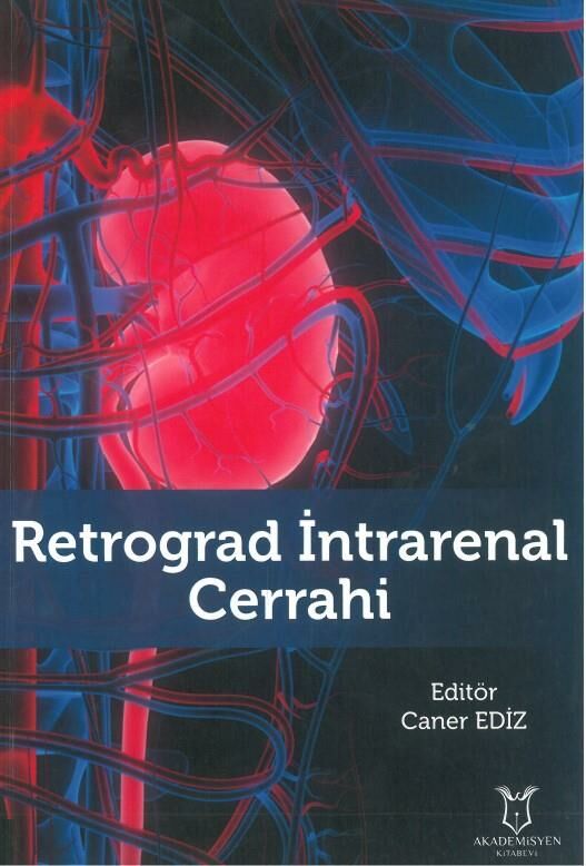 Retrograd İntrarenal Cerrahi