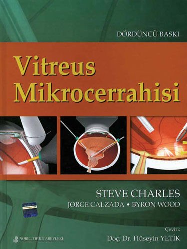 Vitreus Mikrocerrahisi