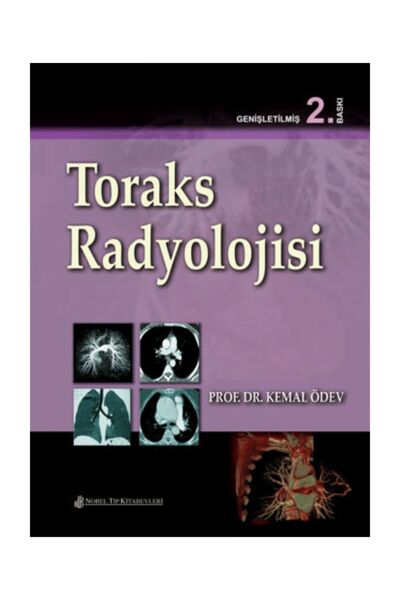 Toraks Radyolojisi ( 2.Baskı )