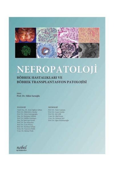 Nefropatoloji: Böbrek Hastalıkları ve Böbrek Transplantasyon Patolojisi