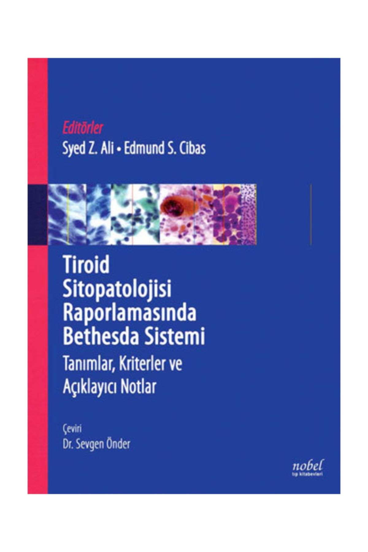 Tiroid Sitopatolojisi Raporlamasında Bethesda Sistemi: Tanımlar, Kriterler ve Açıklayıcı Notlar