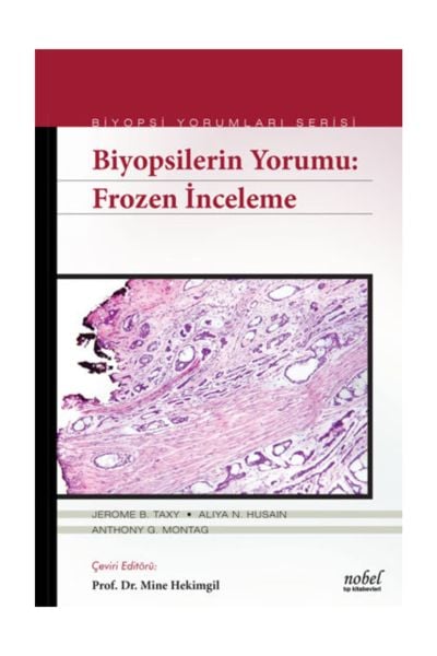 Biyopsilerin Yorumu: Frozen İnceleme - Biyopsi Yorumları Serisi