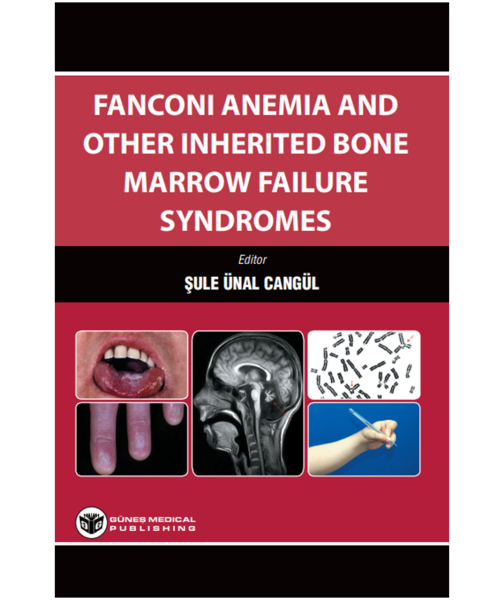 Fanconi Anemia And Other Inherited Bone Marrow Failure Syndromes