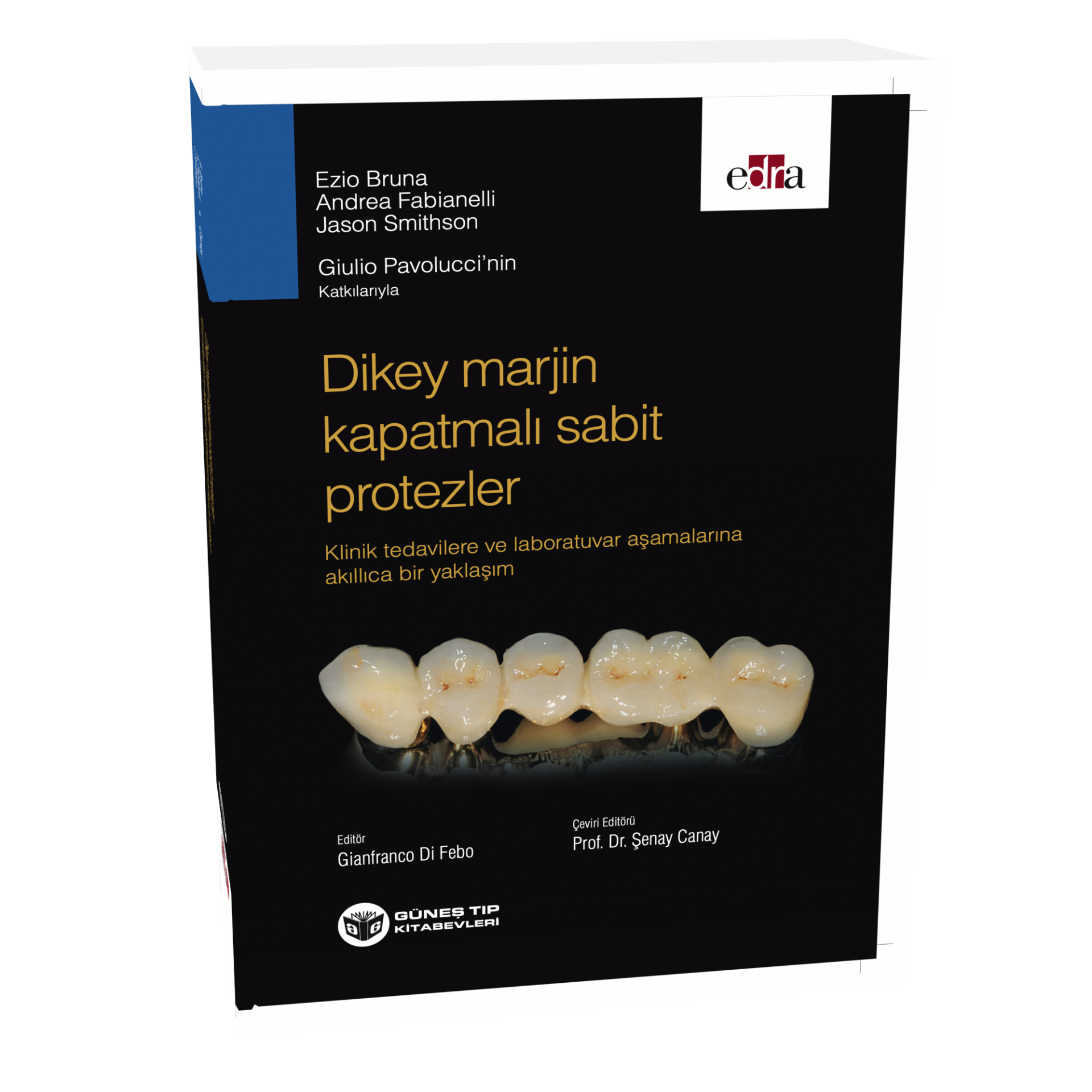 Dikey Marjin Kapatmalı Sabit Protezler