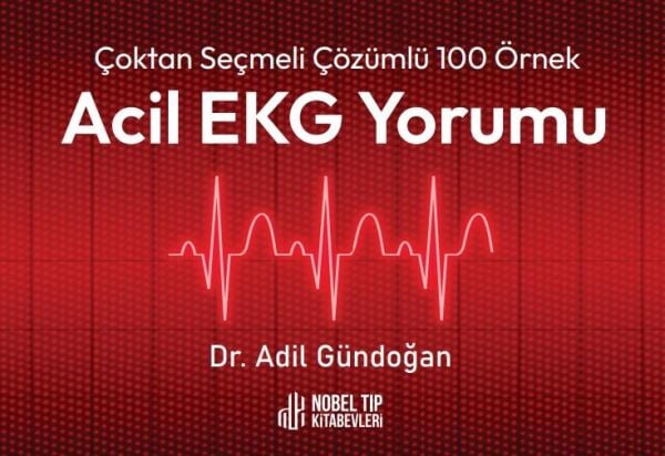 Çoktan Seçmeli Çözümlü 100 Örnek Acil EKG Yorumu