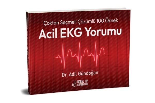 Çoktan Seçmeli Çözümlü 100 Örnek Acil EKG Yorumu