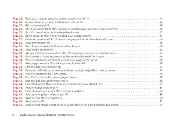 Çoktan Seçmeli Çözümlü 100 Örnek Acil EKG Yorumu