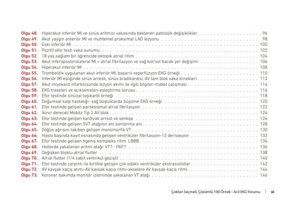 Çoktan Seçmeli Çözümlü 100 Örnek Acil EKG Yorumu