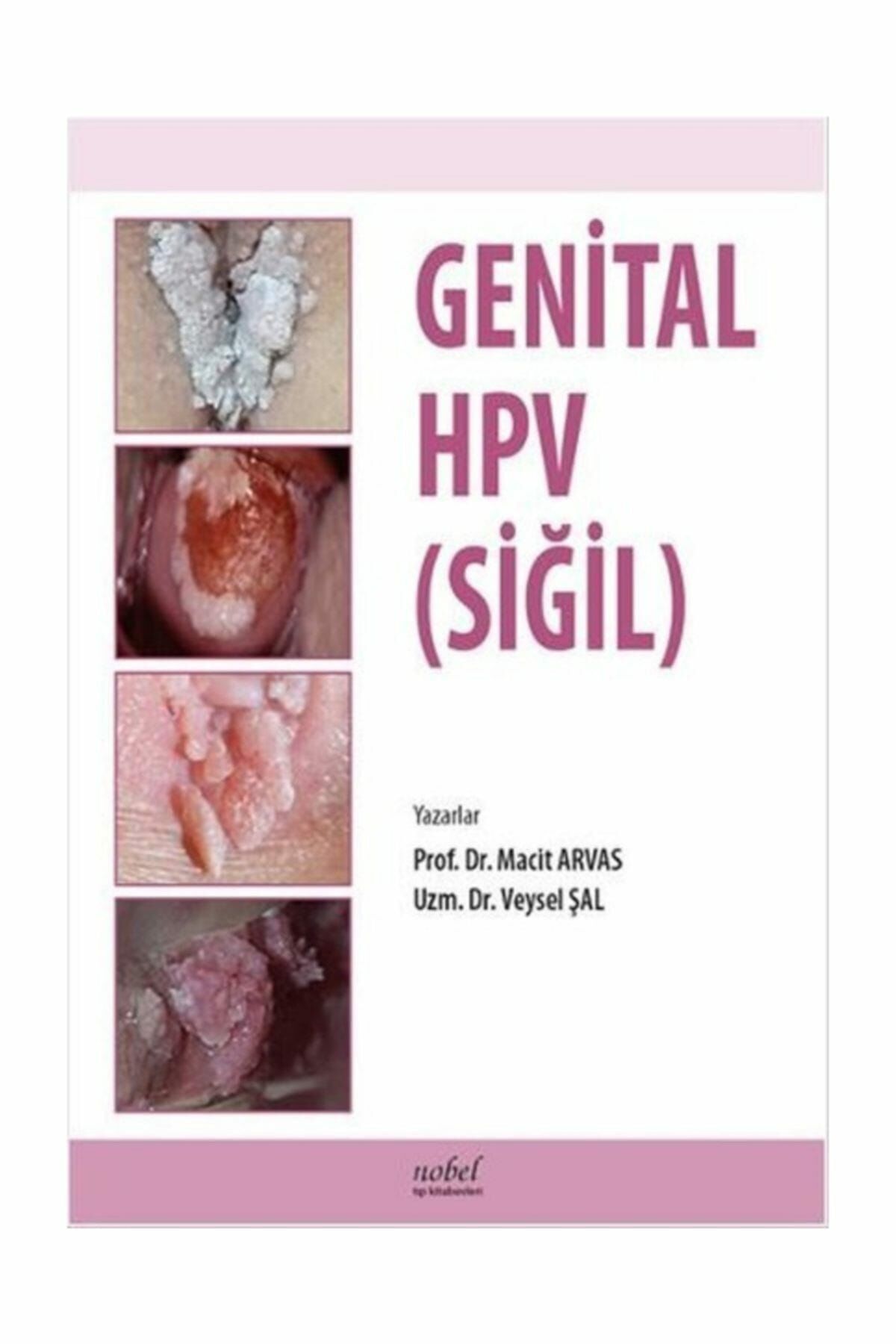 Genital HPV (SİĞİL)