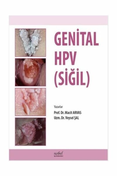 Genital HPV (SİĞİL)
