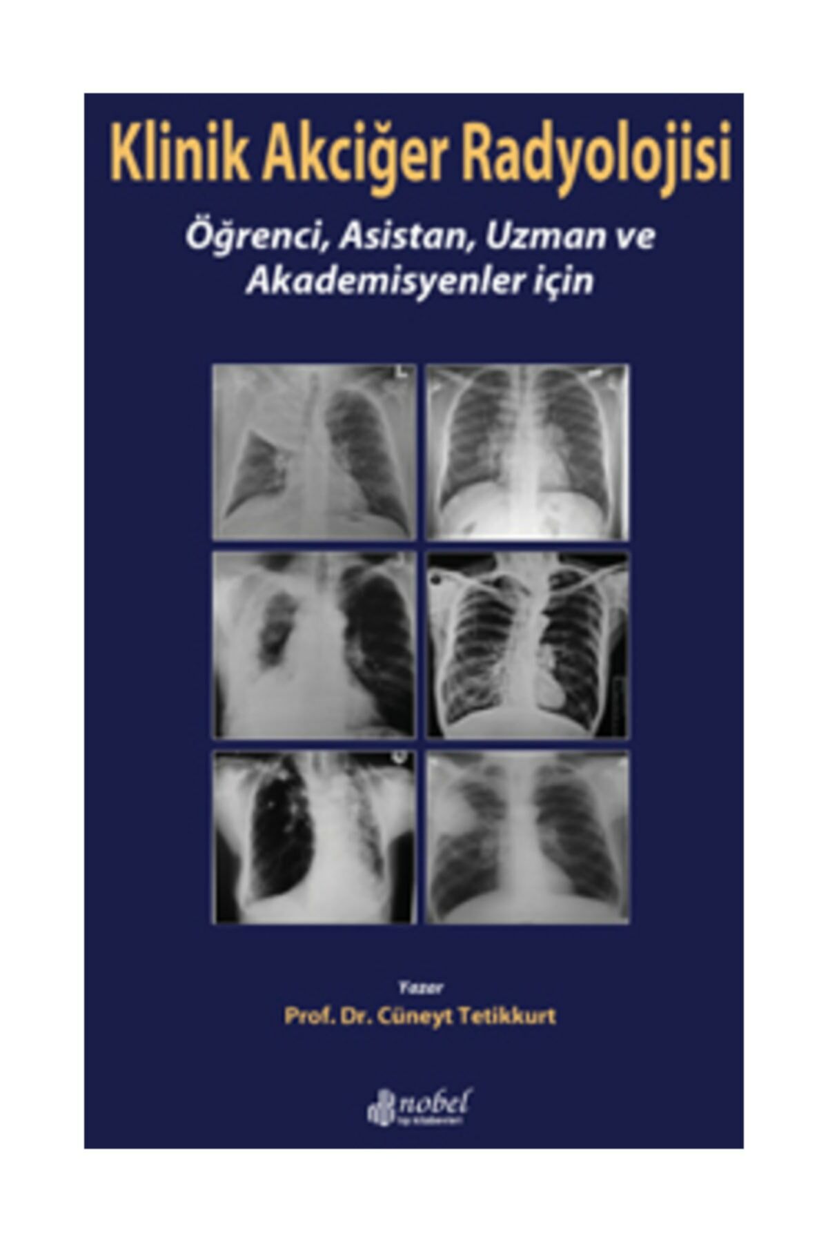 Klinik Akciğer Radyolojisi: Öğrenci, Asistan, Uzman ve Akademisyenler için