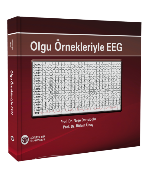 Olgu Örnekleriyle EEG