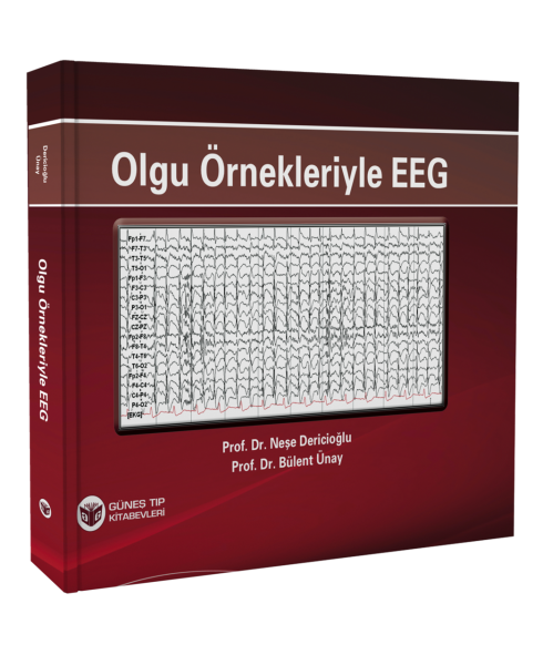 Olgu Örnekleriyle EEG