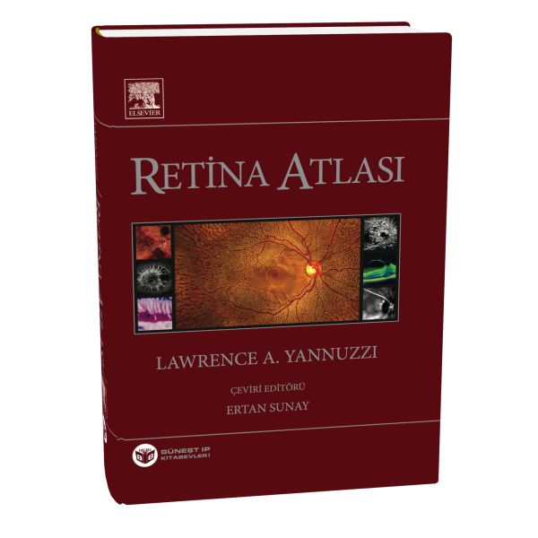 Yannuzzi Retina Atlası