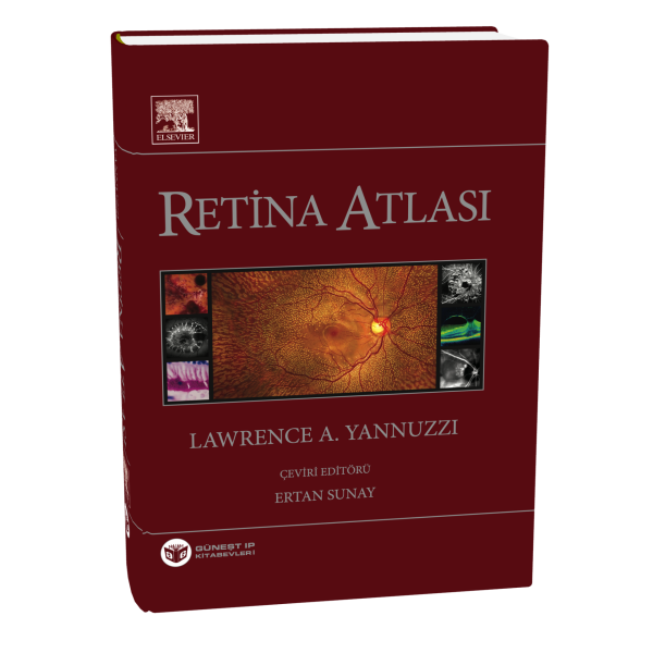 Yannuzzi Retina Atlası