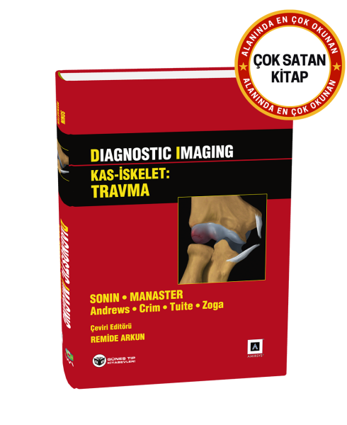 Diagnostic Imaging - Kas İskelet: Travma