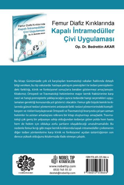 Femur Diafiz Kırıklarında Kapalı İntramedüller Çivi Uygulaması