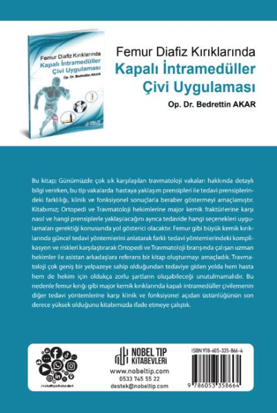 Femur Diafiz Kırıklarında Kapalı İntramedüller Çivi Uygulaması
