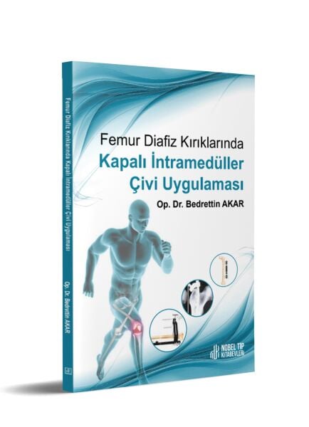 Femur Diafiz Kırıklarında Kapalı İntramedüller Çivi Uygulaması