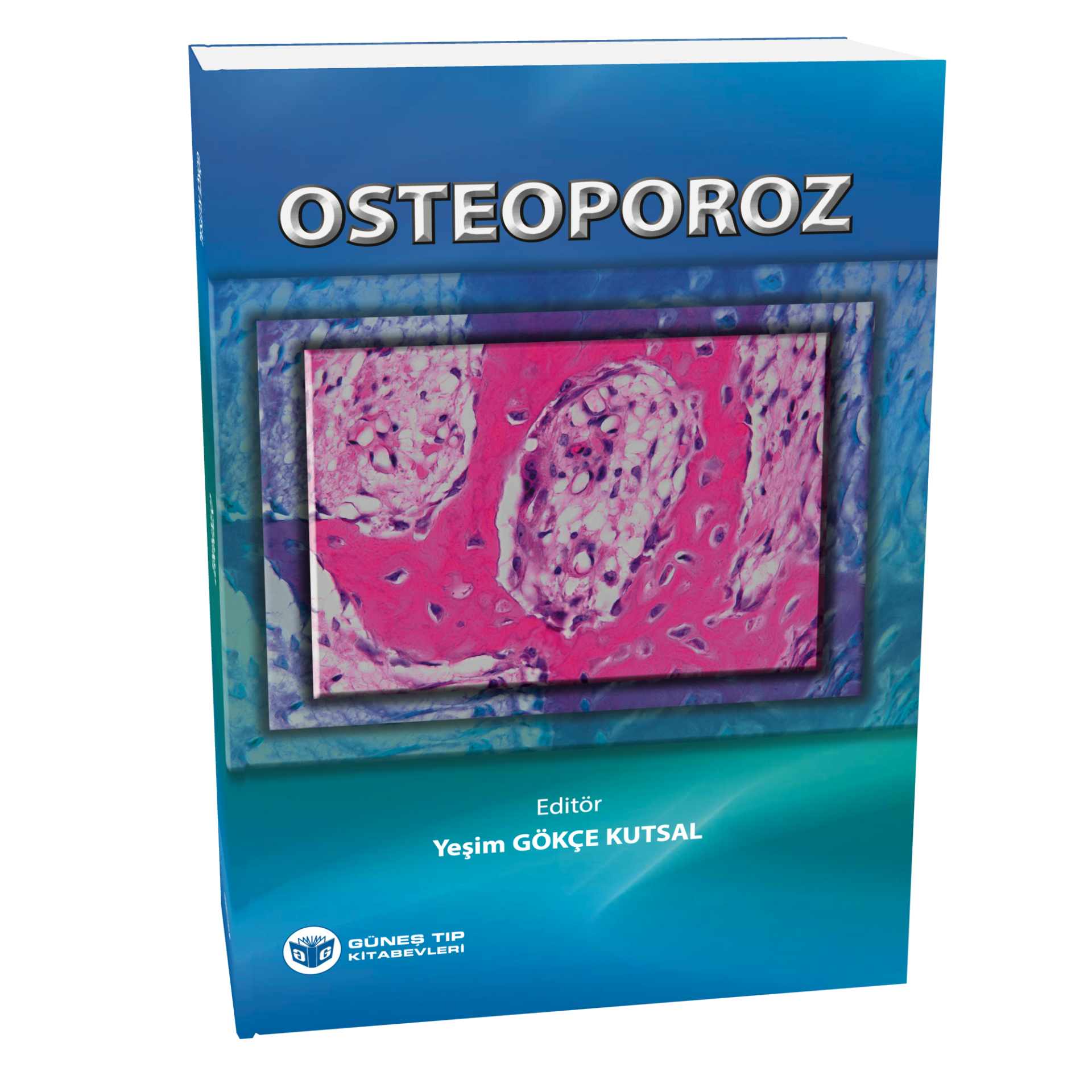 Osteoporoz