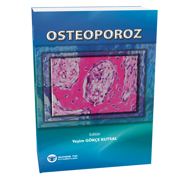 Osteoporoz