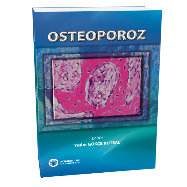Osteoporoz