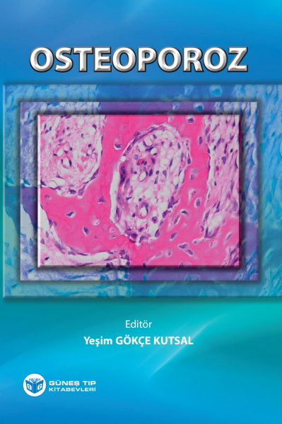 Osteoporoz