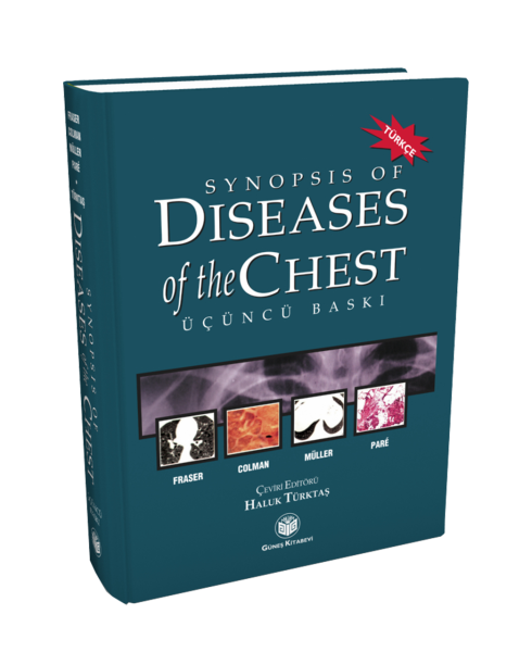 Synopsis of Diseases of The Chest (Türkçesi)