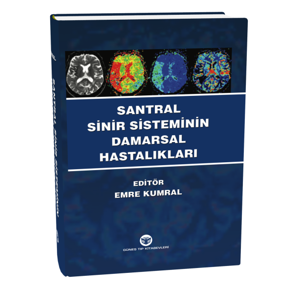 Santral Sinir Sisteminin Damarsal Hastalıkları