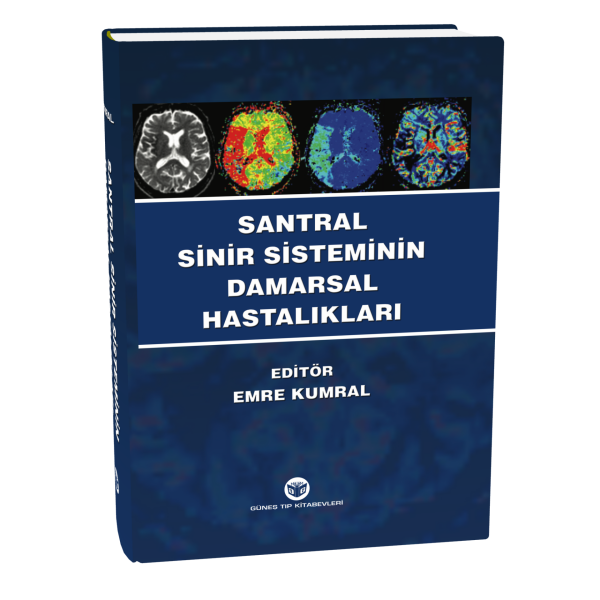 Santral Sinir Sisteminin Damarsal Hastalıkları