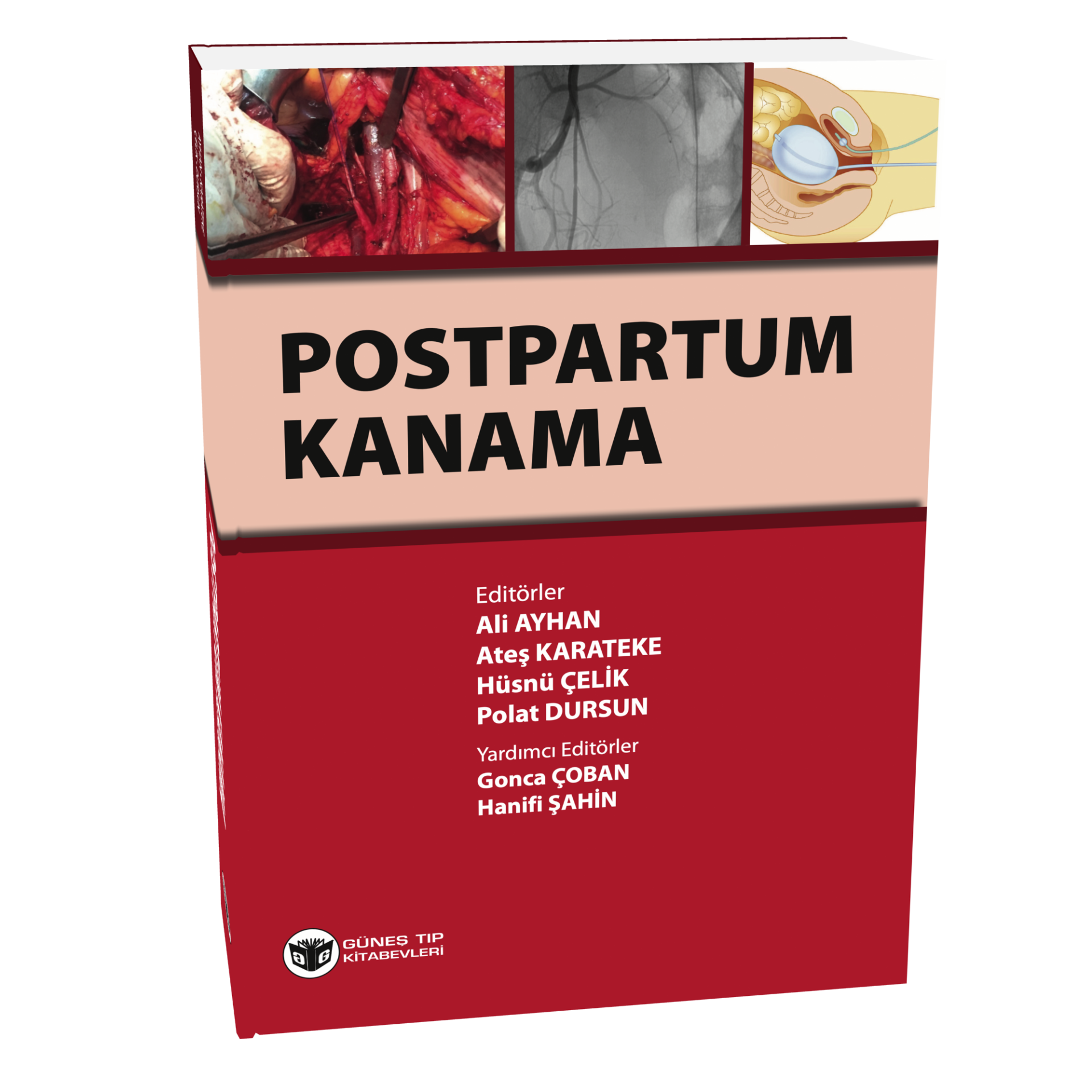 Postpartum Kanama