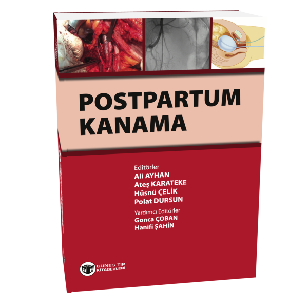 Postpartum Kanama
