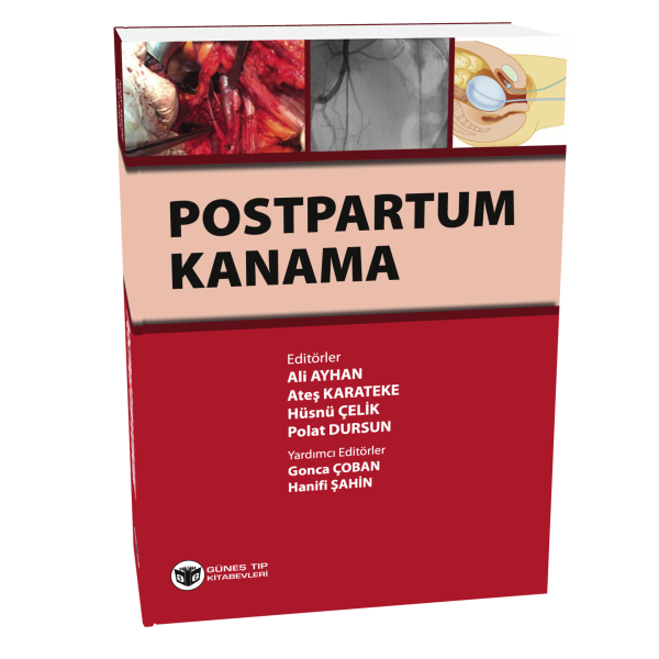Postpartum Kanama