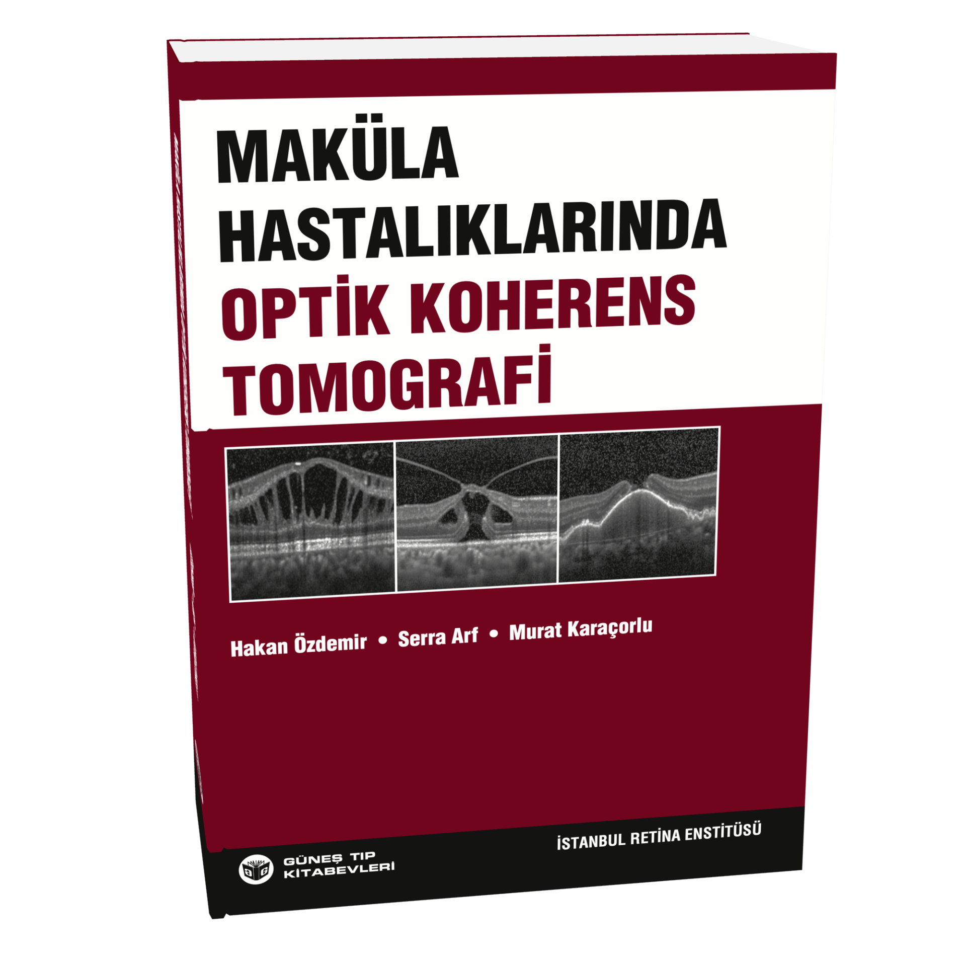 Maküla Hastalıklarında Optik Koherens Tomografi