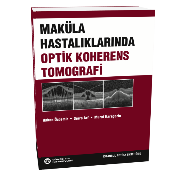 Maküla Hastalıklarında Optik Koherens Tomografi