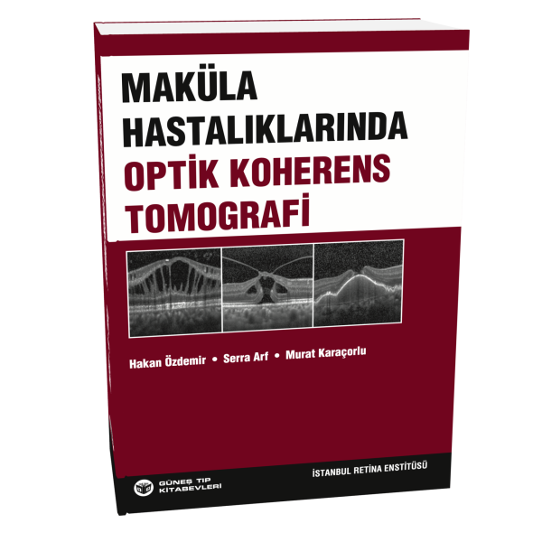 Maküla Hastalıklarında Optik Koherens Tomografi
