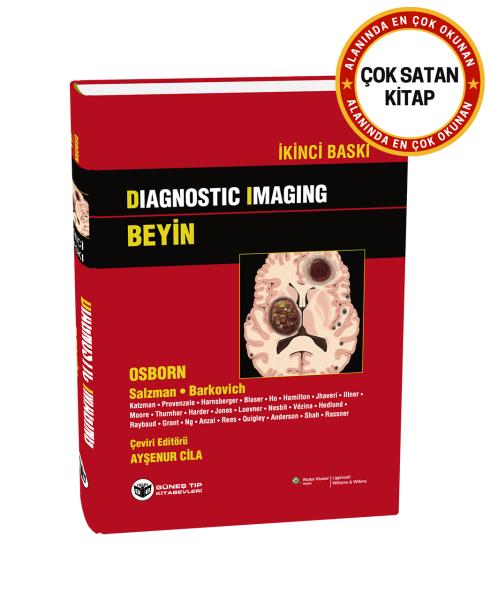 Diagnostic Imaging - Beyin