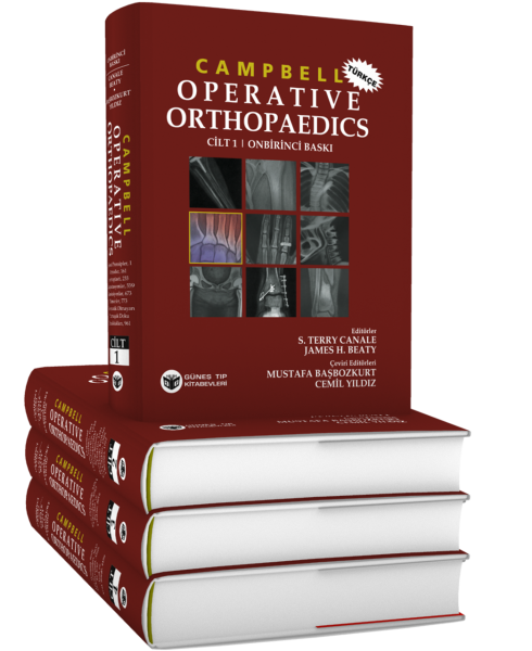 Campbell's Operative Orthopaedics 4 Cilt, Türkçesi