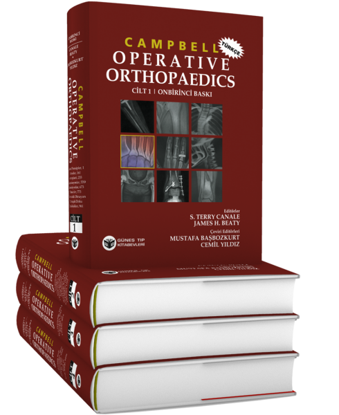 Campbell's Operative Orthopaedics 4 Cilt, Türkçesi