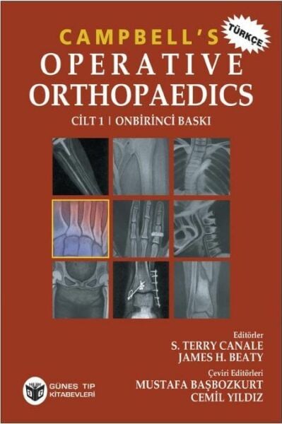 Campbell's Operative Orthopaedics 4 Cilt, Türkçesi