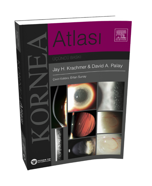 Krachmer Kornea Atlası